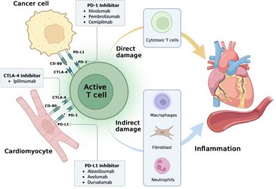 Risk factors for cardiovascular adverse events from immune checkpoint inhibitors